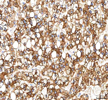 SGK493/PKDCC Rabbit Polyclonal Antibody