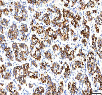 SGK493/PKDCC Rabbit Polyclonal Antibody