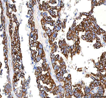 SGK493/PKDCC Rabbit Polyclonal Antibody