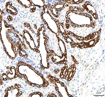 SGK493/PKDCC Rabbit Polyclonal Antibody