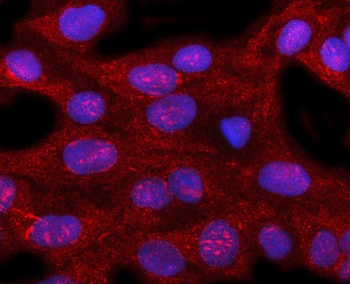 PIR Rabbit Polyclonal Antibody