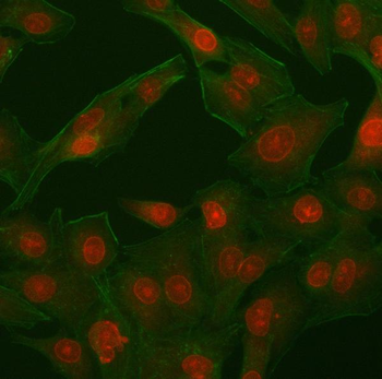PHF11 Rabbit Polyclonal Antibody