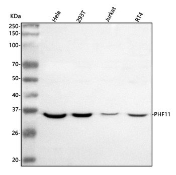 PHF11 Rabbit Polyclonal Antibody