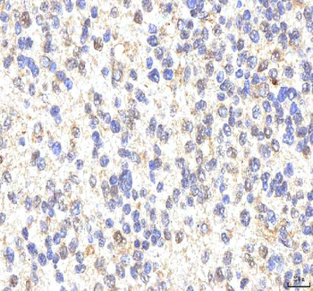 PHF6 Antibody
