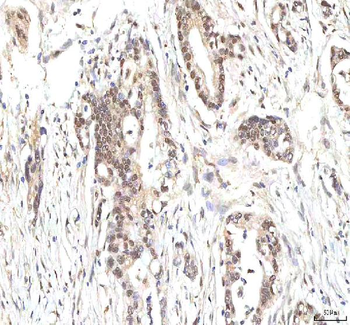 PHF6 Antibody