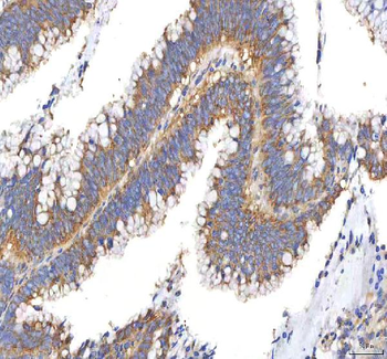 PFKP Rabbit Polyclonal Antibody