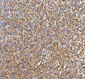 PFKP Rabbit Polyclonal Antibody