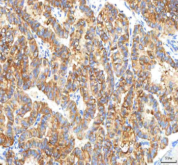 PFKP Rabbit Polyclonal Antibody
