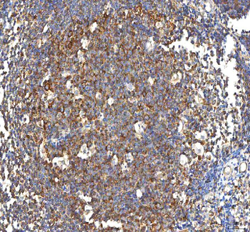 PFKP Rabbit Polyclonal Antibody