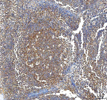 PFKP Rabbit Polyclonal Antibody