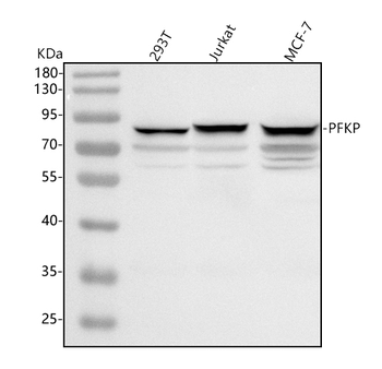 PFKP Rabbit Polyclonal Antibody