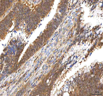 PDXK Rabbit Polyclonal Antibody