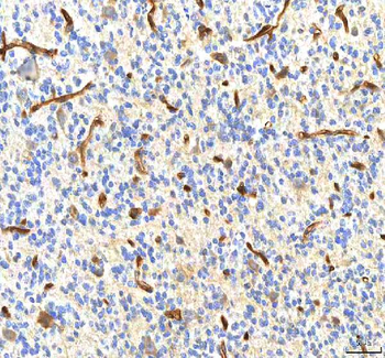 PDXK Rabbit Polyclonal Antibody