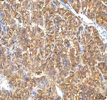 PDXK Rabbit Polyclonal Antibody