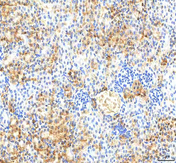 PDXK Rabbit Polyclonal Antibody