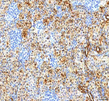 PDXK Rabbit Polyclonal Antibody