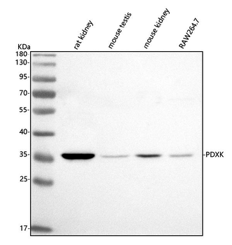 PDXK Rabbit Polyclonal Antibody