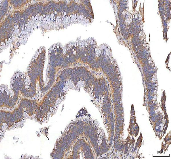 XDH Rabbit Polyclonal Antibody