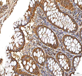 XDH Rabbit Polyclonal Antibody