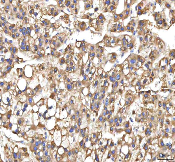 XDH Rabbit Polyclonal Antibody