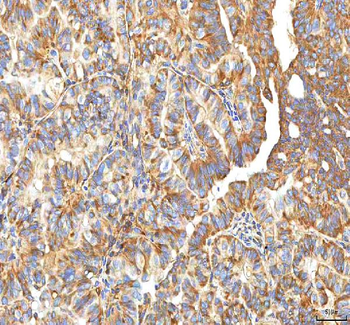 XDH Rabbit Polyclonal Antibody