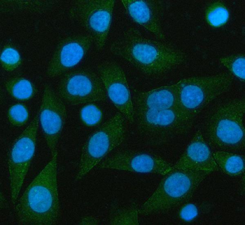 PCMT1 Rabbit Polyclonal Antibody