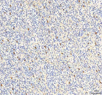 PCMT1 Rabbit Polyclonal Antibody