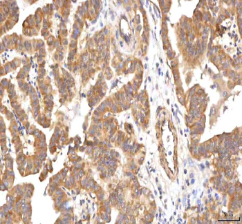 PCMT1 Rabbit Polyclonal Antibody
