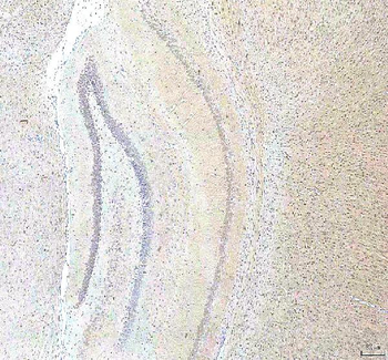 PCMT1 Rabbit Polyclonal Antibody