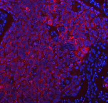 PDF Rabbit Polyclonal Antibody