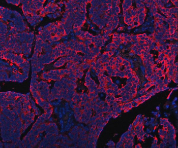 PDF Rabbit Polyclonal Antibody