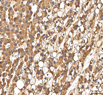 PDF Rabbit Polyclonal Antibody