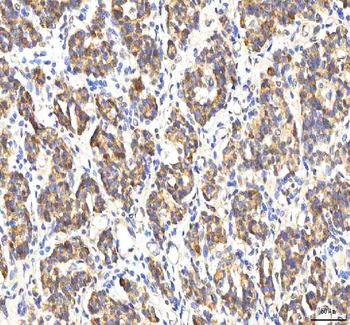PDF Rabbit Polyclonal Antibody