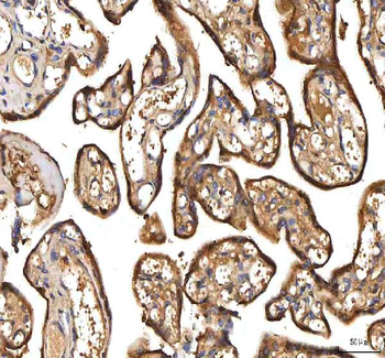 PDF Rabbit Polyclonal Antibody