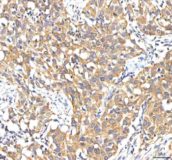 PDF Rabbit Polyclonal Antibody