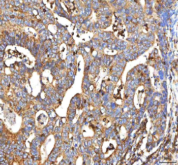 BCAT2 Rabbit Polyclonal Antibody