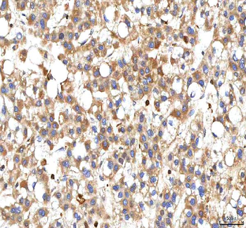 BCAT2 Rabbit Polyclonal Antibody