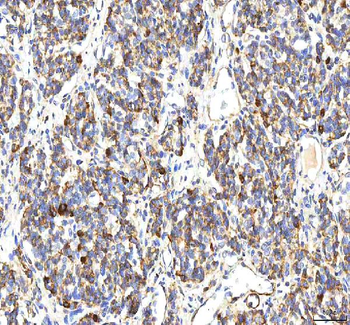 BCAT2 Rabbit Polyclonal Antibody