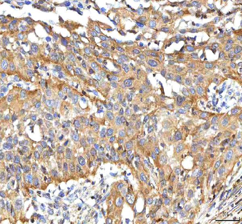 BCAT2 Rabbit Polyclonal Antibody