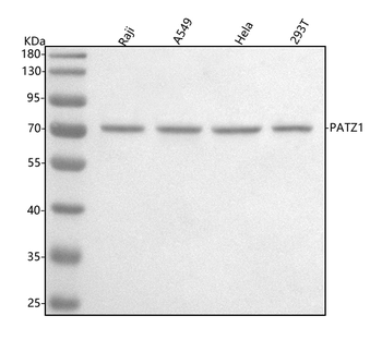 PATZ1 Antibody