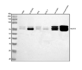 NUMB Rabbit Polyclonal Antibody