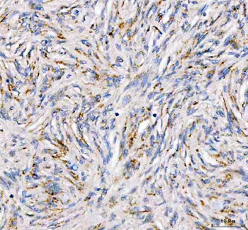 PDK3 Rabbit Polyclonal Antibody