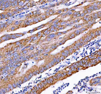 PDK3 Rabbit Polyclonal Antibody