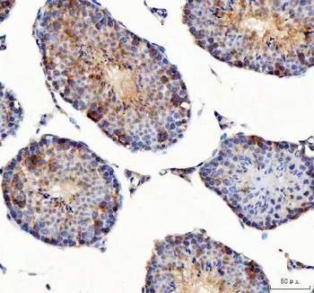 PDK3 Rabbit Polyclonal Antibody