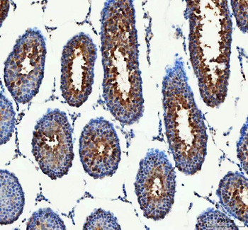 PDK3 Rabbit Polyclonal Antibody