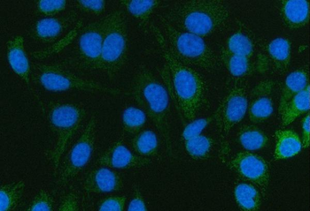 Pyruvate Carboxylase/PC Rabbit Polyclonal Antibody