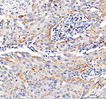 Pyruvate Carboxylase/PC Rabbit Polyclonal Antibody