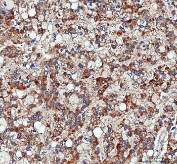 Pyruvate Carboxylase/PC Rabbit Polyclonal Antibody