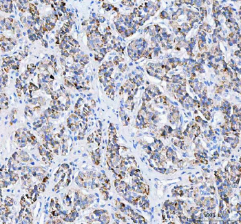 Pyruvate Carboxylase/PC Rabbit Polyclonal Antibody