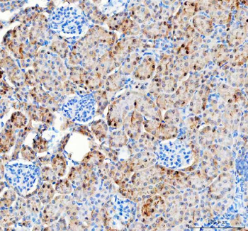 Pyruvate Carboxylase/PC Rabbit Polyclonal Antibody